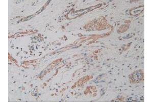 IHC-P analysis of Human Lung Tissue, with DAB staining. (ACTG2 antibody  (AA 3-376))