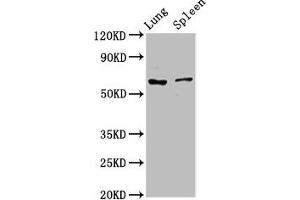 Western Blot Positive WB detected in: Rat lung tissue, Rat spleen tissue All lanes: RIPK2 antibody at 2. (RIPK2 antibody  (AA 1-540))