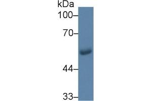 Detection of GLUT1 in Human Saliva using Monoclonal Antibody to Glucose Transporter 1 (GLUT1) (GLUT1 antibody  (AA 251-329))