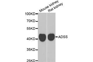 Western blot analysis of extracts of various cell lines, using GATM antibody. (GATM antibody)