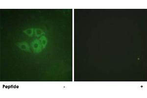 Immunofluorescence analysis of A-549 cells, using PLCB3 polyclonal antibody . (PLCB3 antibody)