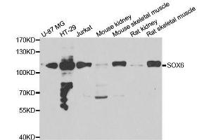 Western blot analysis of extracts of various cell lines, using SOX6 antibody. (SOX6 antibody  (AA 1-74))