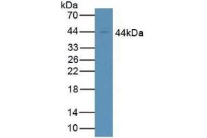 Detection of CD64 in Human Jurkat Cells using Polyclonal Antibody to Cluster Of Differentiation 64 (CD64) (FCGR1A antibody  (AA 73-294))