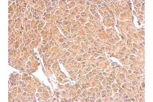IHC-P Image TSPAN3 antibody detects TSPAN3 protein at cytosol on U87 xenograft by immunohistochemical analysis. (Tetraspanin 3 antibody)