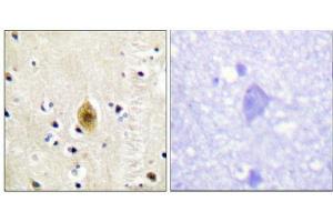 Immunohistochemistry analysis of paraffin-embedded human brain tissue, using Mst1/2 (Phospho-Thr183) antibody. (STK4 antibody  (pThr183))