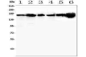 anti-TEK Tyrosine Kinase, Endothelial (TEK) (AA 23-616) antibody