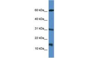 Image no. 1 for anti-Caspase Recruitment Domain Family, Member 17 (CARD17) (AA 51-100) antibody (ABIN6746959)