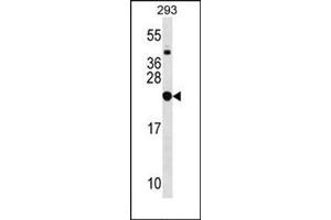 Western blot analysis in 293 cell line lysates (35 ug/lane) using RPL9 Antibody (C-term) Cat. (RPL9 antibody  (C-Term))