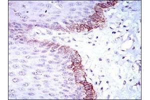 Immunohistochemistry (IHC) image for anti-Breast Cancer 1 (BRCA1) (AA 229-335) antibody (ABIN1846101) (BRCA1 antibody  (AA 229-335))