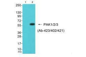 Western blot analysis of extracts from 293 cells (Lane 2), using PAK1/2/3 (Ab-423/402/421) antiobdy. (PAK1/2/3 antibody  (Thr402, Thr421, Thr423))