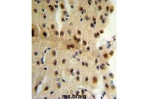 Immunohistochemistry (IHC) image for anti-CAP-GLY Domain Containing Linker Protein 1 (CLIP1) antibody (ABIN3003978) (CLIP1 antibody)