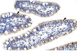 Immunohistochemical staining (Formalin-fixed paraffin-embedded sections) of human intestine with KLHL13 polyclonal antibody . (KLHL13 antibody  (AA 6-55))