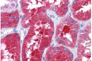 Human Kidney: Formalin-Fixed, Paraffin-Embedded (FFPE) (REEP3 antibody  (C-Term))