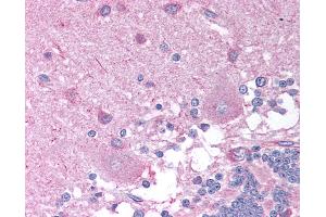 Anti-CHRNB2 antibody IHC of human brain, cerebellum. (CHRNB2 antibody  (AA 21-70))