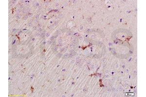 Immunohistochemistry (IHC) image for anti-Preferentially Expressed Antigen in Melanoma (PRAME) (AA 151-250) antibody (ABIN721555) (PRAME antibody  (AA 151-250))