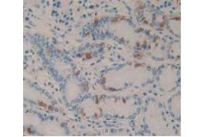 IHC-P analysis of Human Stomach Tissue, with DAB staining. (CCK8 antibody)