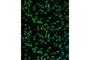 Immunofluorescence analysis of NIH-3T3 cells using U/U/DDX39B Polyclonal Antibody (ABIN6132226, ABIN6139492, ABIN6139493 and ABIN6224384) at dilution of 1:100 (40x lens).