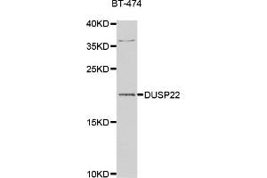 Western blot analysis of extracts of BT-474 cell line, using DUSP22 antibody. (DUSP22 antibody)