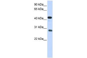CDCA5 antibody used at 1 ug/ml to detect target protein. (CDCA5 antibody  (Middle Region))