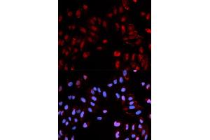 Immunofluorescence analysis of U2OS cells using Phospho-Histone H3-S28 antibody (ABIN5969937). (Histone H3.1 antibody  (pSer29))