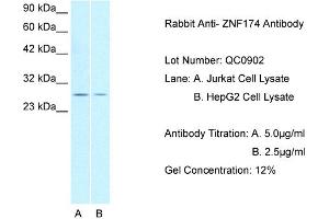 Host: Rabbit Target Name: ZNF174 Sample Type: Lane: A. (ZNF174 antibody  (N-Term))