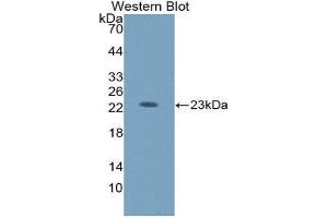 Western Blotting (WB) image for anti-Hexosaminidase B (Beta Polypeptide) (HEXB) (AA 122-311) antibody (ABIN1859140) (HEXB antibody  (AA 122-311))