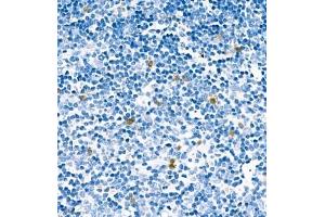 Immunohistochemistry analysis of paraffin embedded mouse thymus using CA13 (ABIN7073310) at dilution of 1: 400 (CA13 antibody)