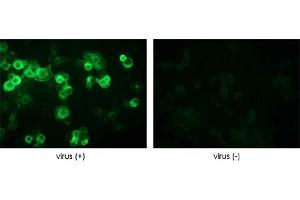 Immunofluorescence detection of baculovirus infected cells. (Baculovirus Envelope gp64 antibody)