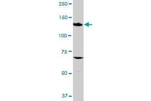 ITGAV MaxPab rabbit polyclonal antibody. (CD51 antibody  (AA 1-1048))