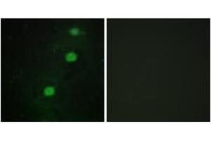 Immunofluorescence (IF) image for anti-Cyclin-Dependent Kinase 20 (CDK20) (AA 31-80) antibody (ABIN2889669) (CCRK antibody  (AA 31-80))