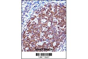 ZAP70 Antibody immunohistochemistry analysis in formalin fixed and paraffin embedded human tonsil tissue followed by peroxidase conjugation of the secondary antibody and DAB staining. (ZAP70 antibody  (AA 276-304))