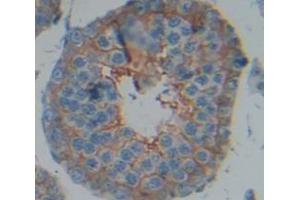 Figure. (ADAM5 antibody  (AA 413-649))