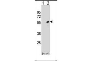 Western blot analysis of RBBP7 (arrow) using RBBP7 / RBAP46 Antibody . (RBBP7 antibody  (Middle Region))