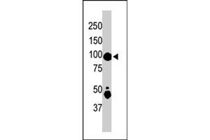 The MAP4K2 polyclonal antibody  is used in Western blot to detect MAP4K2 in mouse skeletal muscle tissue lysate . (MAP4K2 antibody  (Internal Region))