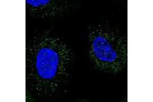 Immunofluorescent staining of human cell line A-431 with WDR48 polyclonal antibody  at 1-4 ug/mL dilution shows positivity in vesicles. (WDR48 antibody)