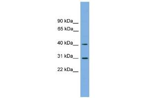 WB Suggested Anti-HSD3B7 Antibody Titration:  0. (HSD3B7 antibody  (Middle Region))