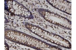Image no. 1 for anti-Tubulin, beta (TUBB) (AA 1-445) antibody (ABIN599619) (TUBB antibody  (AA 1-445))