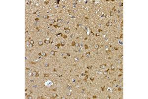 Immunohistochemistry of paraffin-embedded mouse brain using PRPS Rabbit pAb (ABIN7269365) at dilution of 1:100 (40x lens). (PRPSAP2 antibody  (AA 1-90))
