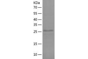 Western Blotting (WB) image for BTB (POZ) Domain-Containing Protein KCTD4 (KCTD4) (AA 1-259) protein (His tag) (ABIN7288099) (KCTD4 Protein (AA 1-259) (His tag))
