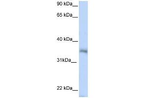 HEXIM2 antibody used at 1 ug/ml to detect target protein. (HEXIM2 antibody  (N-Term))