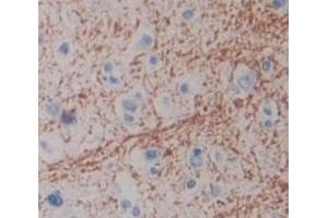 Figure. (CPZ antibody  (AA 425-652))