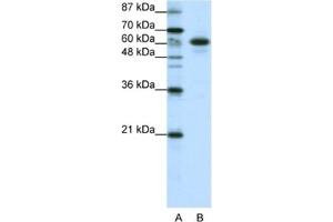 Western Blotting (WB) image for anti-Cas-Br-M (Murine) Ecotropic Retroviral Transforming Sequence-Like 1 (CBLL1) antibody (ABIN2461939) (CBLL1 antibody)