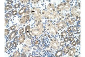 PPIE antibody was used for immunohistochemistry at a concentration of 4-8 ug/ml to stain Epithelial cells of renal tubule (arrows) in Human Kidney. (PPIE antibody)