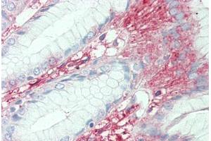 Anti-SLC7A2 antibody  ABIN1049350 IHC staining of human stomach.