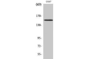 Western Blotting (WB) image for anti-phospholipase C, gamma 1 (PLCG1) (pTyr771) antibody (ABIN3173207) (Phospholipase C gamma 1 antibody  (pTyr771))