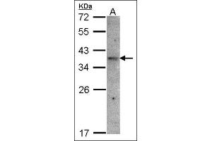 Western blot: Sample(30 µg of whole cell lysate). (OR51E1 antibody)