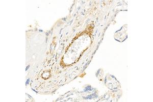Immunohistochemistry of paraffin-embedded human placenta using TAGLN Rabbit pAb (ABIN6128763, ABIN6148829, ABIN6148830 and ABIN6222495) at dilution of 1:25 (40x lens). (Transgelin antibody  (AA 1-201))