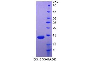 SDS-PAGE (SDS) image for Chromogranin A (CHGA) (AA 15-148) protein (His tag) (ABIN1098961) (Chromogranin A Protein (CHGA) (AA 15-148) (His tag))