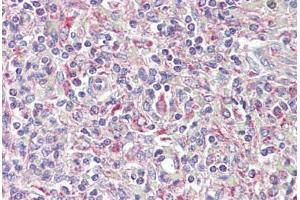 Anti-TRIB1 antibody IHC staining of human spleen. (TRIB1 antibody  (AA 353-366))