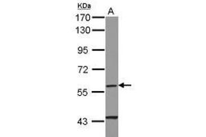 Image no. 1 for anti-Cytochrome P450, Family 4, Subfamily F, Polypeptide 11 (CYP4F11) (AA 1-235) antibody (ABIN1497739) (CYP4F11 antibody  (AA 1-235))